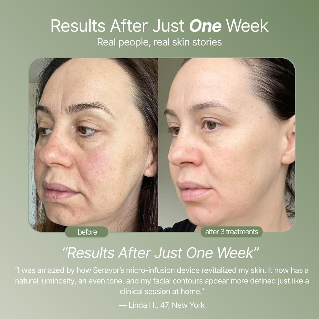 Ditch The Make-up: Embrace a New Level of Confidence with Micro-Infusion
