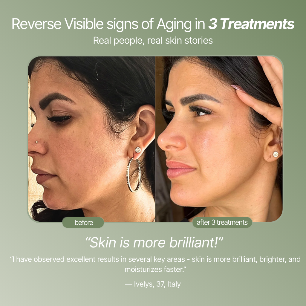 Ditch The Make-up: Embrace a New Level of Confidence with Micro-Infusion